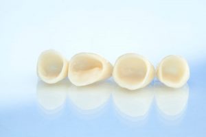 cheap dental implants abroad